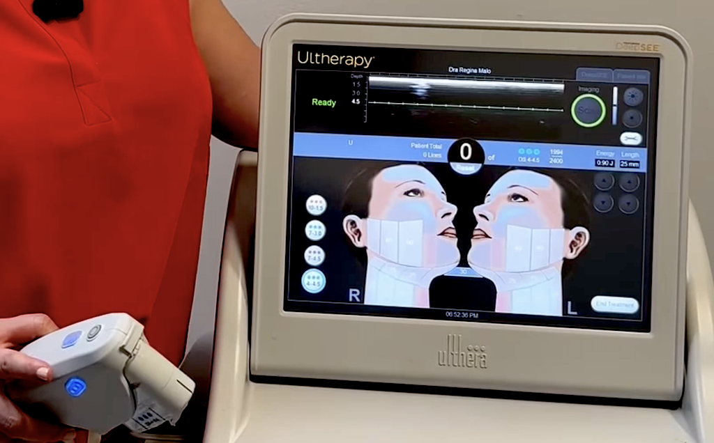 tratamiento Ultherapy monitor